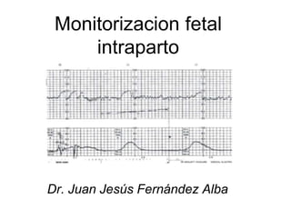 Monitorizacion fetal
intraparto
Dr. Juan Jesús Fernández Alba
 