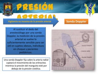 Presión Arterial Vigilancia no invasiva de la presión arterialSonda DopplerAl sustituir el dedo del anestesiólogo por una sonda Doppler, la medición de la presión arterial se vuelve lo suficientemente sensible para ser útil en sujetos obesos, individuos en choque y pacientes pediátricos.Una sonda Doppler fija sobre la arteria radial captará el movimiento de los eritrocitos mientras la presión del manguito esté por debajo de la presión sistólica.