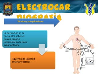 ELECTROCARDIOGRAFÍATécnicas y complicaciones