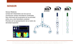 SENSOR
Saboya Sánchez S, Martín Vivas A, Silva Obregón JA, Romera Ortega MÁ, Chamorro Jambrina C, La Torre Marco I,
et al. Monitorización de la Sedación profunda. El monitor BIS®. Enfermería Intensiva. 2009;20(4):159–66. .
Sensor Bilateral®
consta de 6 electrodos con los que se
monitorizan ambos hemisferios cerebrales.
Nos informará de la asimetría en la actividad
entre uno y otro hemisferio cerebral
Permite ver la representación de la matriz de
densidad espectral
 