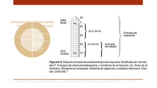 Carrillo R, Castelazo JA. Neuromonitoreo en medicina intensiva Y anestesiología. Editorial Alfil, S.A. de C.V; 2011. .
 