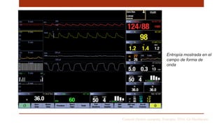 General electric company. Entropia. 2016. Ge Healthcare
Entropía mostrada en el
campo de forma de
onda
 