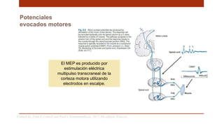 Potenciales
evocados motores
Cottrell JE, Patel P. Cottrell and Patel’s Neuroanesthesia. 2017; 6th edition. Elsevier
El MEP es producido por
estimulación eléctrica
multipulso transcraneal de la
corteza motora utilizando
electrodos en escalpe.
 