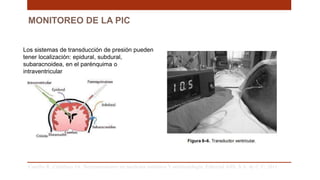 Los sistemas de transducción de presión pueden
tener localización: epidural, subdural,
subaracnoidea, en el parénquima o
intraventricular
MONITOREO DE LA PIC
Carrillo R, Castelazo JA. Neuromonitoreo en medicina intensiva Y anestesiología. Editorial Alfil, S.A. de C.V; 2011. .
 