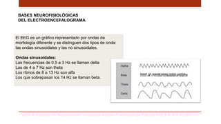 BASES NEUROFISIOLÓGICAS
DEL ELECTROENCEFALOGRAMA
Carrillo R, Castelazo JA. Neuromonitoreo en medicina intensiva Y anestesiología. Editorial Alfil, S.A. de C.V; 2011. .
El EEG es un gráfico representado por ondas de
morfología diferente y se distinguen dos tipos de onda:
las ondas sinusoidales y las no sinusoidales.
Ondas sinusoidales:
Las frecuencias de 0.5 a 3 Hz se llaman delta
Las de 4 a 7 Hz son theta
Los ritmos de 8 a 13 Hz son alfa
Los que sobrepasan los 14 Hz se llaman beta.
 