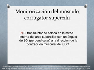 O El transductor se coloca en la mitad
interna del arco superciliar con un ángulo
de 90◦ (perpendicular) a la dirección de la
contracción muscular del CSC.
Monitorización del músculo
corrugator supercilii
 