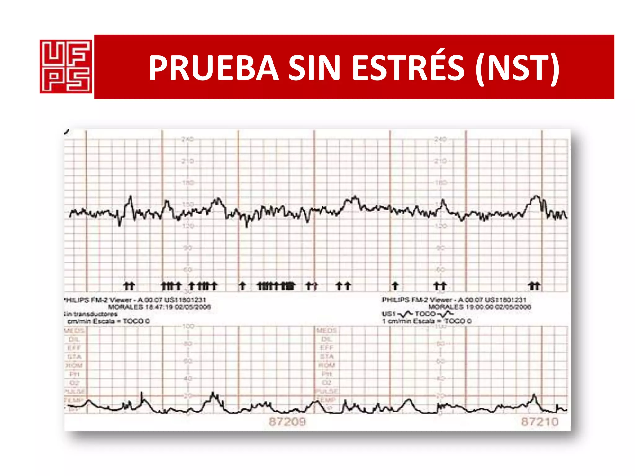 monitorizacion-fetal-pptx
