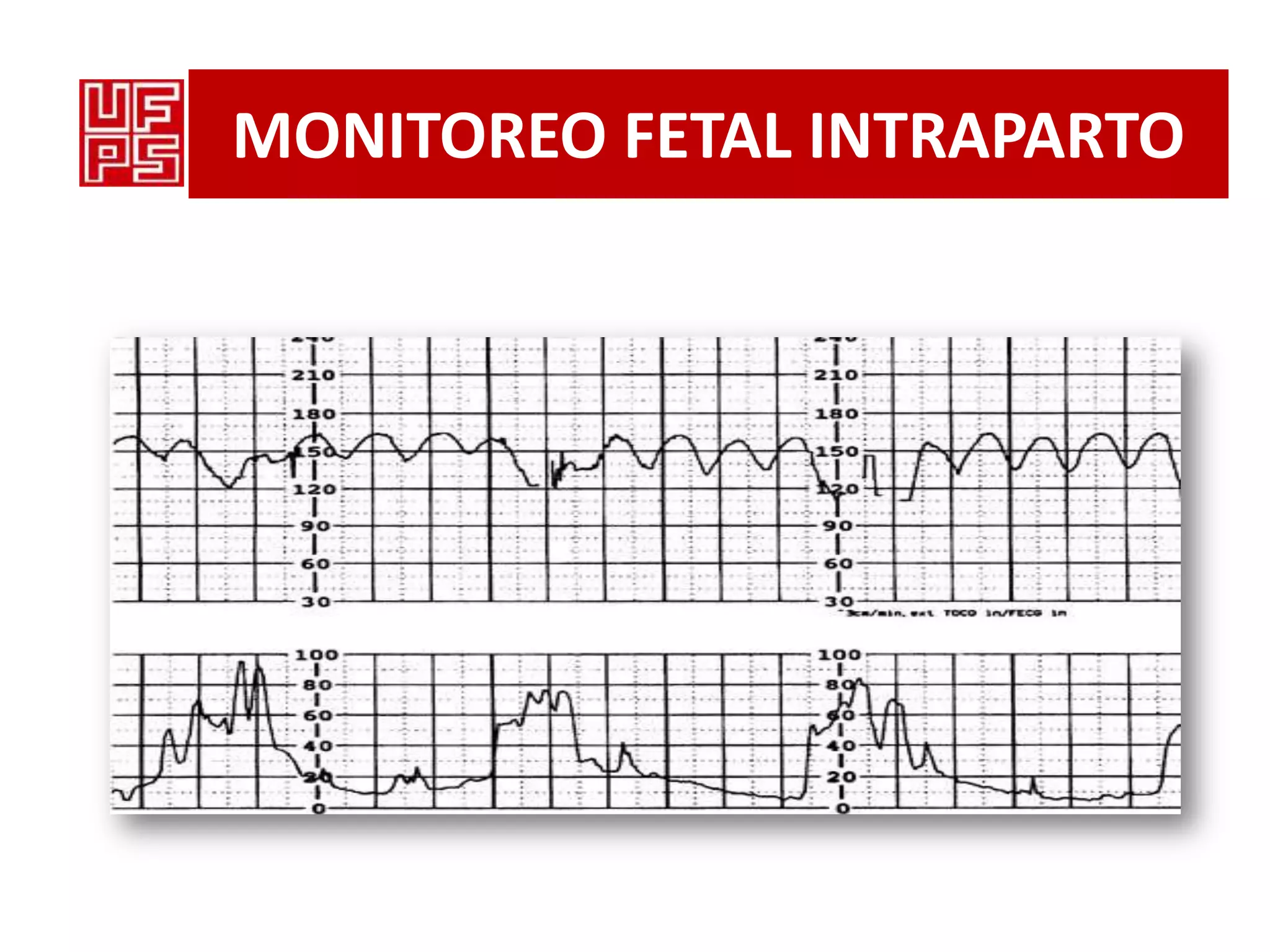 Monitorizacion fetal | PPTX