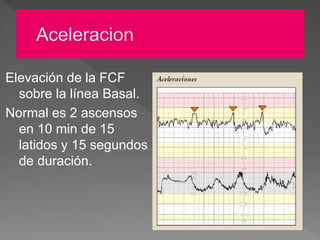 MONITORIZACION FETAL | PPTX