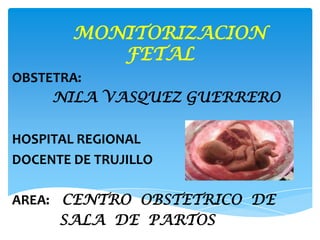 MONITORIZACION
FETAL
OBSTETRA:
NILA VASQUEZ GUERRERO
HOSPITAL REGIONAL
DOCENTE DE TRUJILLO
AREA: CENTRO OBSTETRICO DE
SALA DE PARTOS
 