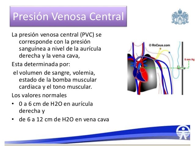 Monitorizacion hemodinamica invasiva Monitorizacion hemodinamica invasiva