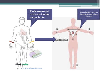 Posicionament
o dos eletrodos
no paciente
Correlação entre as
derivações do plano
frontal
 