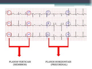 PLANOS VERTICAIS
(MEMBROS)
PLANOS HORIZONTAIS
(PRECORDIAL)
 