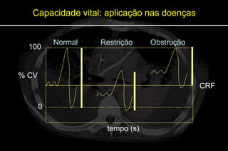 Capacidade vital: aplicação nas doenças


           Normal   Restrição    Obstrução
  100                                        CPT


% CV
                                             CRF

       0                                     VR

                     tempo (s)
 
