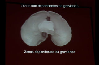 Zonas não dependentes da gravidade




  Zonas dependentes da gravidade
 