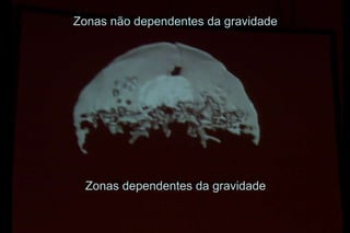 Zonas nãonão dependentes dada gravidade
     Zonas dependentes gravidade




  Zonas dependentesda gravidade
      Zonas dependentes da gravidade
 