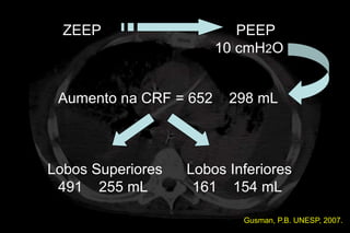 ZEEP                     PEEP
                        10 cmH2O


 Aumento na CRF = 652    298 mL



Lobos Superiores   Lobos Inferiores
 491 255 mL         161 154 mL

                           Gusman, P.B. UNESP, 2007.
 