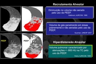Recrutamento Alveolar
               Diminuição no volume não aerado
                 pelo uso da PEEP.
 ZEEP   ZEEP
                                Gattinoni, AJRCCM, 1995




               Volume de gás penetrando em áreas
               pobremente e não aeradas pelo uso da
               PEEP.
                                       Gusman, UNESP 2007



PEEP    PEEP
                   Hiperdistensão Alveolar
               Volume pulmonar caracterizado por
                  atenuações < -900 HU na TC pelo
                  uso da PEEP.
                                       Vieira, AJRCCM, 1999
 