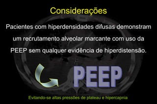 Considerações
Pacientes com hiperdensidades difusas demonstram
  um recrutamento alveolar marcante com uso da
 PEEP sem qualquer evidência de hiperdistensão.




       Evitando-se altas pressões de plateau e hipercapnia
 