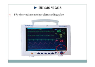 Sinais vitais
4. FR: observada no monitor eletrocardiográfico
 
