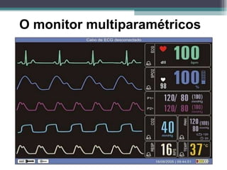 O monitor multiparamétricos
 