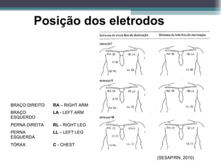 Posição dos eletrodos
(SESAP/RN, 2010)
BRAÇO DIREITO RA – RIGHT ARM
BRAÇO
ESQUERDO
LA - LEFT ARM
PERNA DIREITA RL - RIGHT LEG
PERNA
ESQUERDA
LL – LEFT LEG
TÓRAX C - CHEST
 
