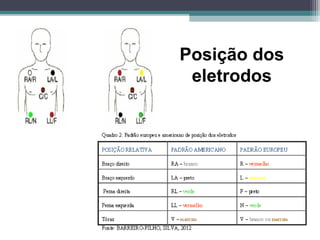 Posição dos
eletrodos
 