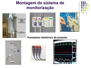 Montagem do sistema de
monitorização
Transdutor eletrônico de pressão
 