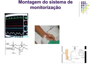 Montagem do sistema de
monitorização
 