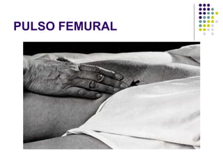 PULSO FEMURAL
 