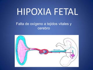 CAUSAS DE HIPOXIA FETAL
              Complicaciones
                Anteparto




Disfunción       Hipoxia       Perfusió...