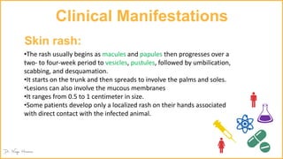 Clinical Manifestations
•The rash usually begins as macules and papules then progresses over a
two- to four-week period to vesicles, pustules, followed by umbilication,
scabbing, and desquamation.
•It starts on the trunk and then spreads to involve the palms and soles.
•Lesions can also involve the mucous membranes
•It ranges from 0.5 to 1 centimeter in size.
•Some patients develop only a localized rash on their hands associated
with direct contact with the infected animal.
Skin rash:
 
