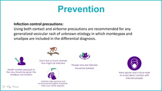 Prevention
Infection control precautions:
Using both contact and airborne precautions are recommended for any
generalized vesicular rash of unknown etiology in which monkeypox and
smallpox are included in the differential diagnosis.
 