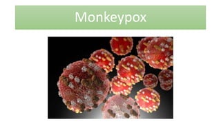 Monkeypox
 