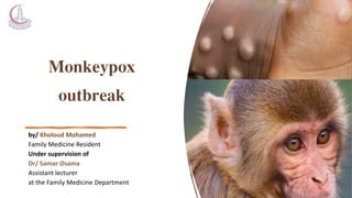Monkeypox
outbreak
by/ Kholoud Mohamed
Family Medicine Resident
Under supervision of
Dr/ Samar Osama
Assistant lecturer
at the Family Medicine Department
 