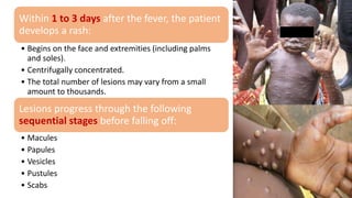 Within 1 to 3 days after the fever, the patient
develops a rash:
• Begins on the face and extremities (including palms
and soles).
• Centrifugally concentrated.
• The total number of lesions may vary from a small
amount to thousands.
Lesions progress through the following
sequential stages before falling off:
• Macules
• Papules
• Vesicles
• Pustules
• Scabs
 