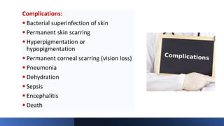 Complications:
 Bacterial superinfection of skin
 Permanent skin scarring
 Hyperpigmentation or
hypopigmentation
 Permanent corneal scarring (vision loss)
 Pneumonia
 Dehydration
 Sepsis
 Encephalitis
 Death
 