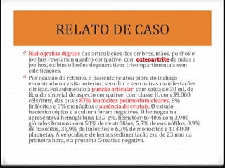 RELATO DE CASO
0 Radiografias digitais das articulações dos ombros, mãos, punhos e
joelhos revelaram quadro compatível com osteoartriteosteoartrite de mãos e
joelhos, exibindo lesões degenerativas tricompartimentais sem
calcificações.
0 Por ocasião do retorno, o paciente relatou piora do inchaço
encontrado na visita anterior, sem dor e sem outras manifestações
clínicas. Foi submetido à punção articular, com saída de 30 mL de
líquido sinovial de aspecto compatível com classe II, com 39.000
céls/mm3
, das quais 87% leucócitos polimorfonucleares, 8%
linfócitos e 5% monócitos e ausência de cristais. O estudo
bacterioscópico e a cultura foram negativos. O hemograma
apresentava hemoglobina 13,7 g%, hematócrito 40,6 com 3.900
glóbulos brancos com 50% de neutrófilos, 5,5% de eosinófilos, 0,9%
de basófilos, 36,9% de linfócitos e 6,7% de monócitos e 113.000
plaquetas. A velocidade de hemossedimentação era de 23 mm na
primeira hora, e a proteína C-reativa negativa.
 