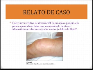 RELATO DE CASO
0 Houve nova recidiva de derrame 24 horas após a punção, em
grande quantidade, doloroso, acompanhado de sinais
inflamatórios exuberantes (rubor e calor) e febre de 38,4ºC
 