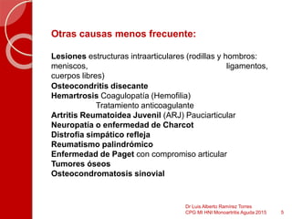 Otras causas menos frecuente:
Lesiones estructuras intraarticulares (rodillas y hombros:
meniscos, ligamentos,
cuerpos libres)
Osteocondritis disecante
Hemartrosis Coagulopatía (Hemofilia)
Tratamiento anticoagulante
Artritis Reumatoidea Juvenil (ARJ) Pauciarticular
Neuropatía o enfermedad de Charcot
Distrofia simpático refleja
Reumatismo palindrómico
Enfermedad de Paget con compromiso articular
Tumores óseos
Osteocondromatosis sinovial
5
Dr Luis Alberto Ramírez Torres
CPG MI HNI Monoartritis Aguda 2015
 