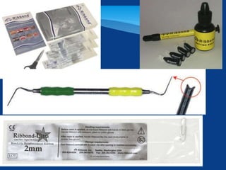 Monoblation Design dental Monoblock obturation technique or concept in endodontics | PPTX