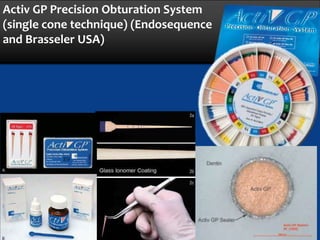 dental Monoblock obturation technique or concept in endodontics | PPTX