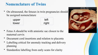 Nomenclature of Twins
• On ultrasound, the fetuses in twin pregnancies should be
be assigned nomenclature
• Fetus A should be with amniotic sac closest to the
maternal cervix
• Document cord insertions and relation to placenta
• Labelling critical for anomaly tracking and delivery
planning
• Standardize labelling from early scans for clarity
upper
lower
left
right
 