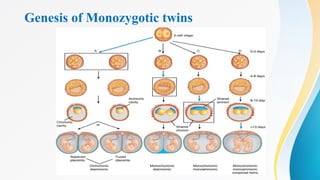 Genesis of Monozygotic twins
 