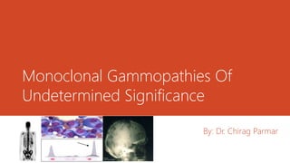 Monoclonal Gammopathies Of
Undetermined Significance
By: Dr. Chirag Parmar
 