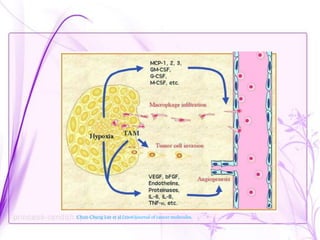 Monocytes macrophages in human cancer | PPTX