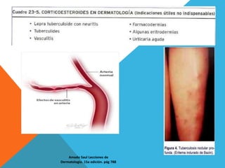 Amado Saul Lecciones de
Dermatologia. 15a edición. pág 788
 
