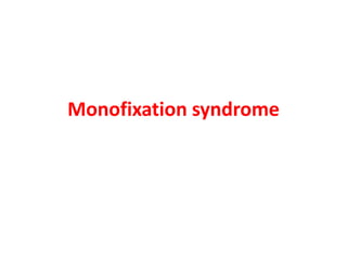 Monofixation syndrome
 