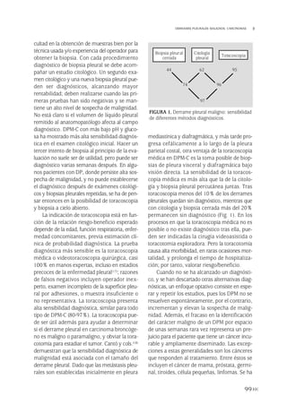 cultad en la obtención de muestras bien por la
técnica usada y/o experiencia del operador para
obtener la biopsia. Con cada procedimiento
diagnóstico de biopsia pleural se debe acom-
pañar un estudio citológico. Un segundo exa-
men citológico y una nueva biopsia pleural pue-
den ser diagnósticos, alcanzando mayor
rentabilidad; deben realizarse cuando las pri-
meras pruebas han sido negativas y se man-
tiene un alto nivel de sospecha de malignidad.
No está claro si el volumen de líquido pleural
remitido al anatomopatólogo afecta al campo
diagnóstico. DPM-C con más bajo pH y gluco-
sa ha mostrado más alta sensibilidad diagnós-
tica en el examen citológico inicial. Hacer un
tercer intento de biopsia al principio de la eva-
luación no suele ser de utilidad, pero puede ser
diagnóstico varias semanas después. En algu-
nos pacientes con DP, donde persiste alta sos-
pecha de malignidad, y no puede establecerse
el diagnóstico después de exámenes citológi-
cos y biopsias pleurales repetidas, se ha de pen-
sar entonces en la posibilidad de toracoscopia
y biopsia a cielo abierto.
La indicación de toracoscopia está en fun-
ción de la relación riesgo-beneficio esperado
depende de la edad, función respiratoria, enfer-
medad concomitantes, previa estimación clí-
nica de probabilidad diagnóstica. La prueba
diagnóstica más sensible es la toracoscopia
médica o videotoracoscopia quirúrgica, casi
100% en manos expertas, incluso en estadios
precoces de la enfermedad pleural(17); razones
de falsos negativos incluyen operador inex-
perto, examen incompleto de la superficie pleu-
ral por adhesiones, o muestra insuficiente o
no representativa. La toracoscopia presenta
alta sensibilidad diagnóstica, similar para todo
tipo de DPM-C (80-97%). La toracoscopia pue-
de ser útil además para ayudar a determinar
si el derrame pleural en carcinoma broncóge-
no es maligno o paramaligno, y obviar la tora-
cotomía para estadiar el tumor. Cantó y cols.(18)
demuestran que la sensibilidad diagnóstica de
malignidad está asociada con el tamaño del
derrame pleural. Dado que las metástasis pleu-
rales son establecidas inicialmente en pleura
mediastínica y diafragmática, y más tarde pro-
gresa cefálicamente a lo largo de la pleura
parietal costal, otra ventaja de la toracoscopia
médica en DPM-C es la toma posible de biop-
sias de pleura visceral y diafragmática bajo
visión directa. La sensibilidad de la toracos-
copia médica es más alta que la de la citolo-
gía y biopsia pleural percutánea juntas. Tras
toracoscopia menos del 10% de los derrames
pleurales quedan sin diagnóstico, mientras que
con citología y biopsia cerrada más del 20%
permanecen sin diagnóstico (Fig. 1). En los
procesos en que la toracoscopia médica no es
posible o no existe diagnóstico tras ella, pue-
den ser indicadas la cirugía videoasistida o
toracotomia exploradora. Pero la toracotomía
causa alta morbibidad, en raras ocasiones mor-
talidad, y prolonga el tiempo de hospitaliza-
ción; por tanto, valorar riesgo/beneficio.
Cuando no se ha alcanzado un diagnósti-
co, y se han descartado otras alternativas diag-
nósticas, un enfoque optativo consiste en espe-
rar y repetir los estudios, pues los DPM no se
resuelven espontáneamente, por el contrario,
incrementan y elevan la sospecha de malig-
nidad. Además, el fracaso en la identificación
del carácter maligno de un DPM por espacio
de unas semanas rara vez representa un pre-
juicio para el paciente que tiene un cáncer incu-
rable y ampliamente diseminado. Las excep-
ciones a estas generalidades son los cánceres
que responden al tratamiento. Entre éstos se
incluyen el cáncer de mama, próstata, germi-
nal, tiroides, célula pequeñas, linfomas. Se ha
99
DERRAMES PLEURALES MALIGNOS. CARCINOMAS
FIGURA 1. Derrame pleural maligno: sensibilidad
de diferentes métodos diagnósticos.
Biopsia pleural
cerrada
Citología
pleural
Toracoscopia
44 62 95
74 96
97
Pleura 224p 9/7/13 10:23 Página 99
 