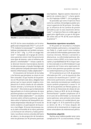 46-52% de los casos estudiados con la tomo-
grafía axial computarizada (TAC)(7,8) y en un 69-
77% mediante la toracoscopia(9,10). Las lesiones
bullosas contralaterales son también comunes,
54% en TAC(11) (Fig. 1) y 93% en cirugía bila-
teral(12). Comparado con el grupo de control,
estos pacientes tienen más frecuentemente
otros tipos de lesiones, como el enfisema sub-
pleural o centrilobulillar(13). Incluso cuando no
se detectan lesiones macroscópicas durante
la videotoracoscopia, el estudio histológico del
vértice pulmonar extirpado demuestra siempre
lesiones enfisematosas o bullas subpleurales(14).
El mecanismo de formación de las bullas
y los factores que precipitan su rotura no son
bien conocidos. El que muchos de los pacien-
tes con NE primario sean altos y delgados hace
pensar que la mayor presión negativa intra-
pleural en el vértice resulta de una sobredis-
tensión alveolar y la formación de bullas en
esta zona(15). Otra teoría es que la relativamente
baja perfusión en el vértice pulmonar de estos
pacientes produce una lesión isquémica y for-
mación de bullas subpleurales(16). Los estudios
recientes sobre enfisema pulmonar aportan
datos sobre la hipótesis del desequilibrio pro-
teasas-antiproteasas inducido por el exceso de
estrés oxidativo y la participación de leucoci-
tos y macrófagos. El exceso de proteasas cau-
sa un daño irreversible de la matriz pulmonar
y la formación de enfisema y bullas pulmo-
nares. Los efectos nocivos conocidos del humo
de tabaco y la alta proporción de fumadores
entre los pacientes con NE primario potencian
esta hipótesis. Algunos autores relacionan el
patrón de conducta tipo A(17) y factor genéti-
co, HLA haplotipo A2B40(18), con la patogenia.
Se postulaba que tanto el ejercicio físico
como los cambios climatológicos podían pro-
vocar la aparición de NE primario. Sin embar-
go, la influencia de los cambios de presión
atmosférica aún no está claramente demos-
trada(19) y el ejercicio físico en sí debe jugar un
papel poco significativo ya que en dos gran-
des series sólo un 9% de NE ocurre durante
su práctica(15).
Neumotórax espontáneo secundario
El NE puede ser secundario a múltiples
enfermedades pulmonares y extrapulmona-
res (Tabla 2), y suele ocurrir como complica-
ción tardía de enfermedades pulmonares des-
tructivas (necrosis, fibrosis o cavitación) u
obstructivas. La enfermedad pulmonar obs-
tructiva crónica (EPOC) es la causa más fre-
cuente y la probabilidad de NE es mayor cuan-
to más avanzada es la enfermedad por lo que
la aparición de N tiene seria repercusión clí-
nica en estos pacientes que poseen una reser-
va cardiorrespiratoria ya muy limitada.
El N se presenta en un 2-6% de pacientes
infectados por HIV, y en la mayoría de ellos
se asocia con neumonía por P. carinii(20). Las
infecciones pulmonares cavitadas (tubercu-
losis, neumonía necrotizante por estafilococo)
tienen también propensión a causar N. Un
10% de los pacientes con fibrosis quística, un
25% de los de histiocitosis de células de Lan-
gerhans y hasta un 80% de los de linfangio-
leiomiomatosis(21) pueden complicarse con N
en el curso de la enfermedad. La necrosis del
tumor pulmonar, tanto primario como metas-
tásico, con apertura a la cavidad pleural, pue-
de dar origen a N. El N catamenial se produ-
ce dentro de 48 a 72 horas después del
comienzo de la menstruación en mujeres que
tienen antecedente de endometriosis pélvica.
Neumotórax adquirido
Muchos actos médicos pueden tener como
complicación el N. La toracocentesis, la biop-
183
NEUMOTÓRAX Y HEMOTÓRAX
FIGURA 1. Lesiones bullosas contralaterales.
Pleura 224p 9/7/13 10:23 Página 183
 